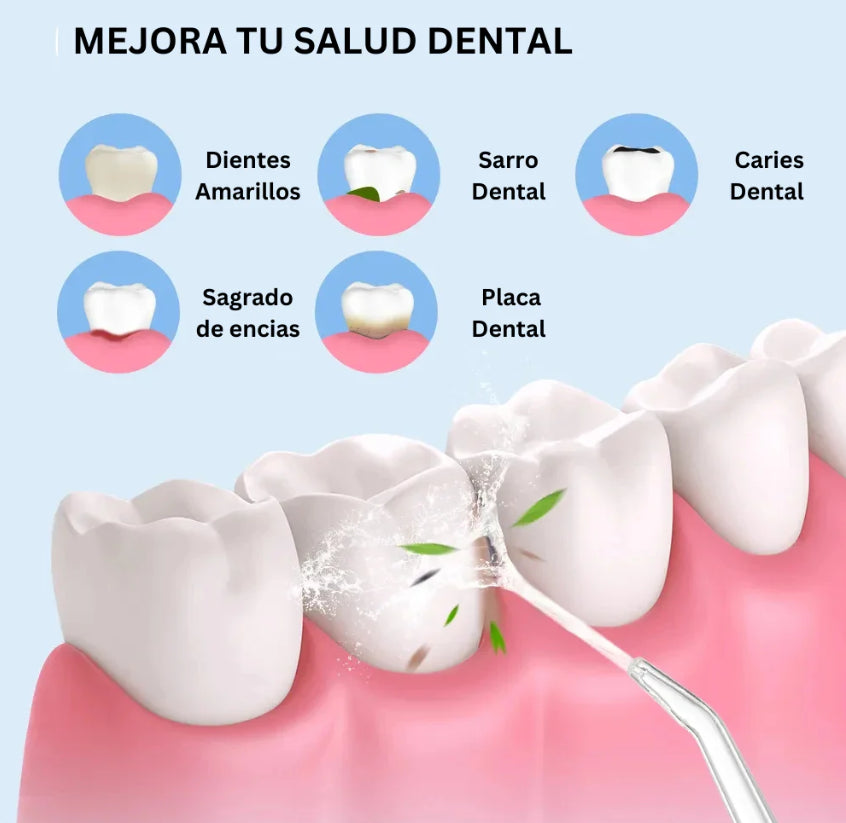 Irrigador Bucal - Sonrisa y Aliento Impecable